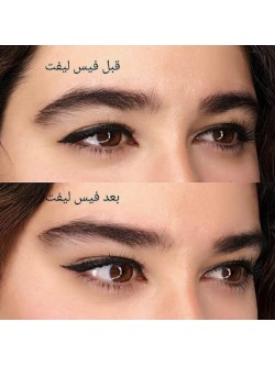 کش لیفت شقیقه و ابرو بسته 1 عددی
