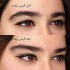 کش لیفت شقیقه و ابرو بسته 1 عددی