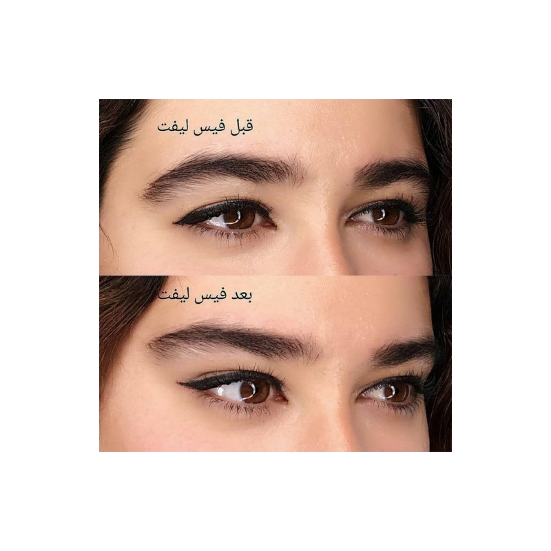 کش لیفت شقیقه و ابرو بسته 1 عددی